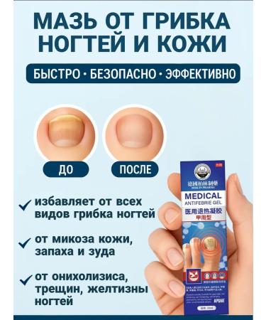 Chinese ointment from nail fungus - Buy Online on GoSupps.com
