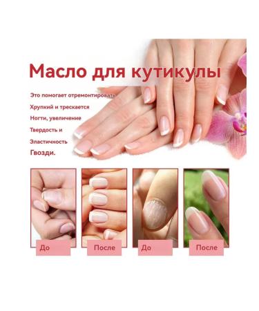 eelhoe Suppress fungi Nogin care oil improves the appearance - Buy Online on GoSupps.com