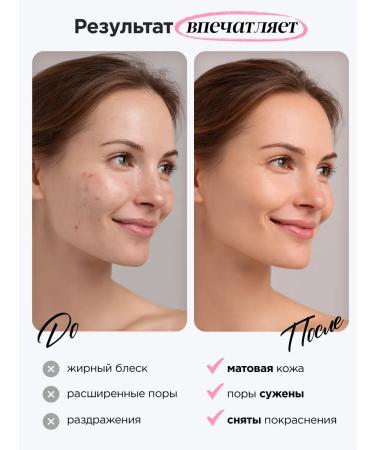 MIXIT Mating face tonic with niacinamide - Buy Online on GoSupps.com