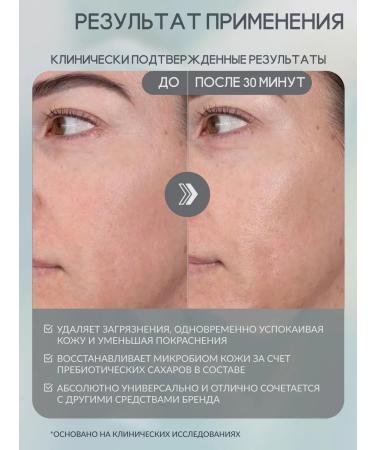 Paula's Choice Foam for sensitive skin 198 ml - Buy Online on GoSupps.com