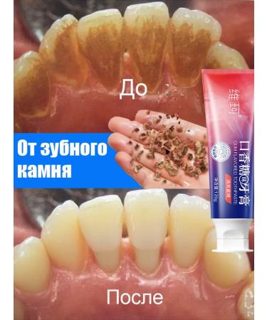 Toothpaste whitening from plaque and stone Fresh breath