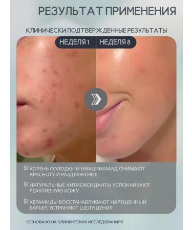 Paula's Choice Cream for problem skin 60 ml - Buy Online on GoSupps.com