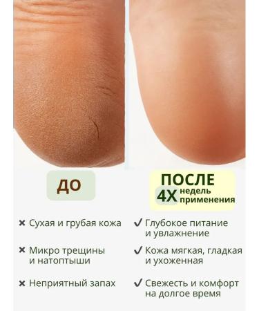 BEONA Moisturizer with urea - Buy Online on GoSupps.com