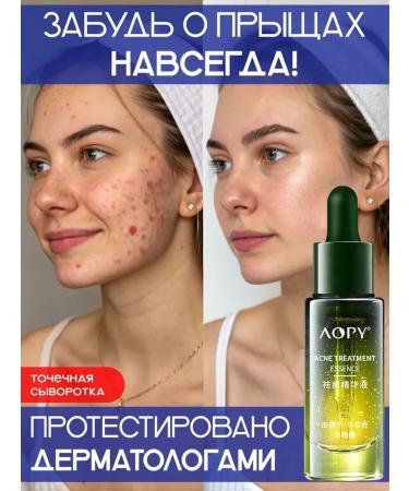 Serum for correction of acne and post -acne 30 ml