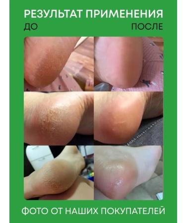 Space heels Keratolytic remedy for heels - Buy Online on GoSupps.com