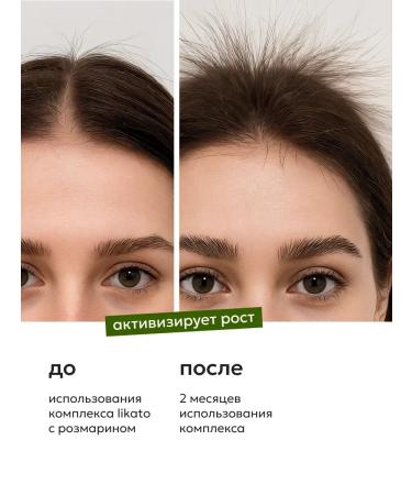 Likato professional Hair growth from falling out a strengthening 30 ml - Buy Online on GoSupps.com