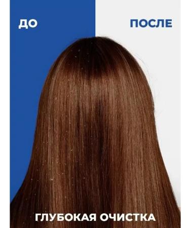 Head & Shoulders Set of shampoos from dandruff 3pcs 1200ml - Buy Online on GoSupps.com