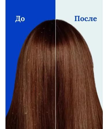 Head & Shoulders Set of shampoos 3pcs 1200ml - Buy Online on GoSupps.com