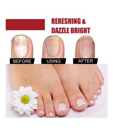 Eelhoe fluid for restoration of nails fast action - Buy Online on GoSupps.com