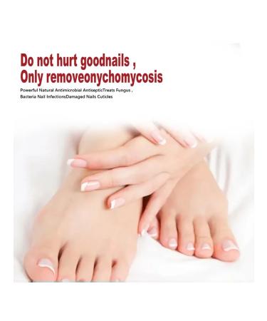 Eelhoe fluid for restoration of nails fast action - Buy Online on GoSupps.com