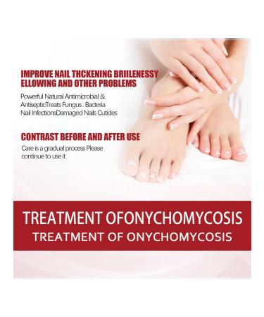 Eelhoe fluid for restoration of nails fast action - Buy Online on GoSupps.com