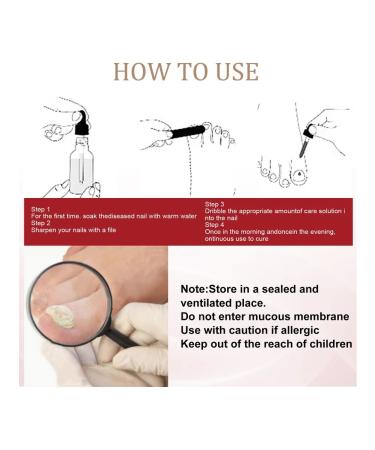 Eelhoe fluid for restoration of nails fast action - Buy Online on GoSupps.com