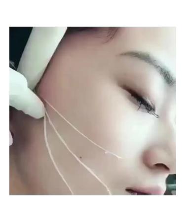 12pcs bag of threads for facial lifting resolved collagen - Buy Online on GoSupps.com