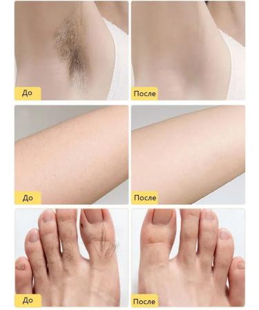 LYDIMOON Cream for depilation 100 g 5 minutes quickly and painlessly - Buy Online on GoSupps.com