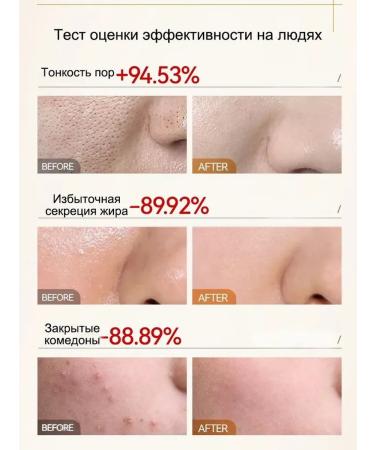 LYDIMOON Current serum for narrowing pores against acne 30 ml - Buy Online on GoSupps.com