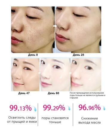 LYDIMOON Current serum for narrowing pores against acne 30 ml - Buy Online on GoSupps.com