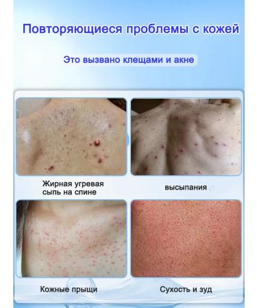 IUALLURE Shower gel against acne 1500ml - Buy Online on GoSupps.com