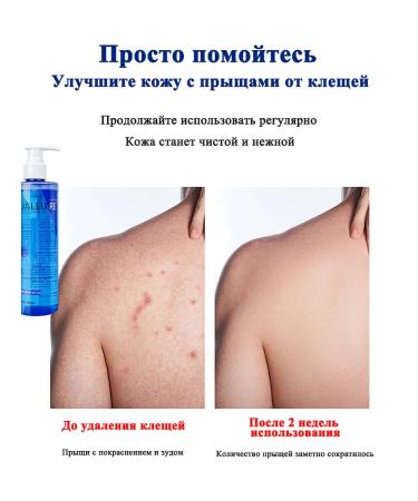 IUALLURE Shower gel against acne 1500ml - Buy Online on GoSupps.com