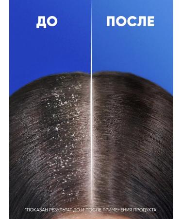 Head & Shoulders Shampoo from dandruff Male Complex Care 2v1 360ml - Buy Online on GoSupps.com