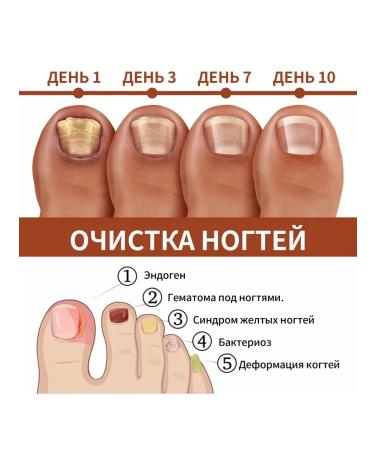 the nail strengthen the entity of the entity to contribute to a healthy growth - Buy Online on GoSupps.com