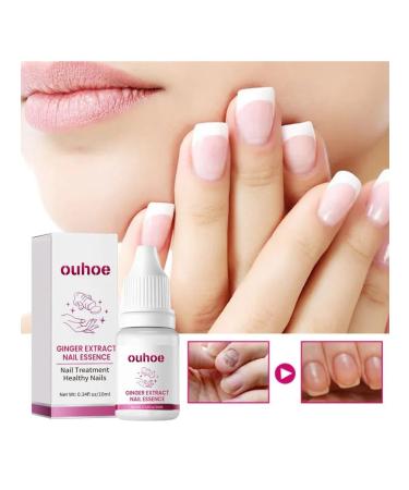 ginger fungus of nails repair essence prevent a fracture - Buy Online on GoSupps.com