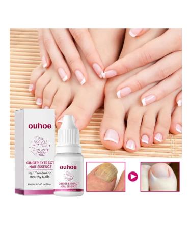 ginger fungus of nails repair essence prevent a fracture - Buy Online on GoSupps.com