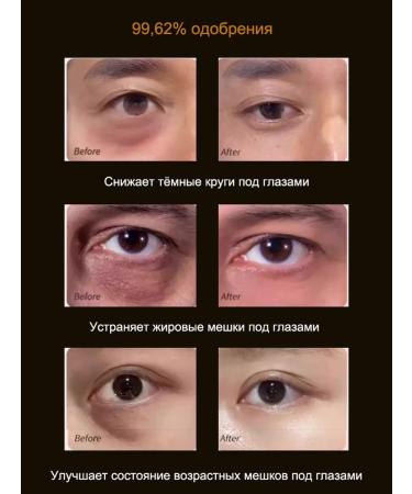 LYDIMOON Anti -aging eye cream with retinol 35 g - Buy Online on GoSupps.com