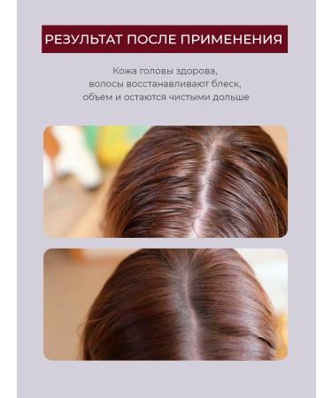 FOLTENE Pharma Salusfant oily hair shampoo - Buy Online on GoSupps.com