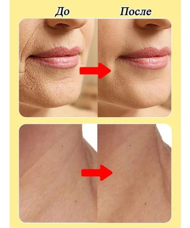 LYDIMOON Face cream anti -aging against wrinkles - Buy Online on GoSupps.com