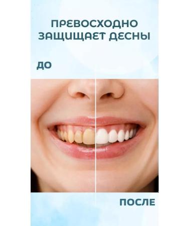 PERIOE Tooth pastry set 3X - Buy Online on GoSupps.com