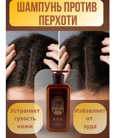 VipZak Medical shampoo is therapeutic. For problem skin