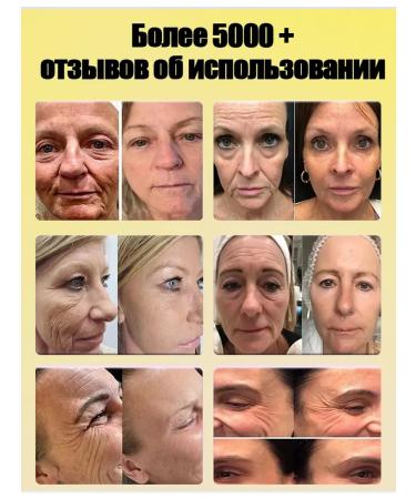 LYDIMOON Feature and skin anti -aging cream around the eyes with collagen - Buy Online on GoSupps.com