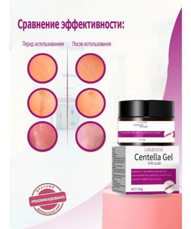 Scars cream after operations and cesarean section 30 g - Buy Online on GoSupps.com