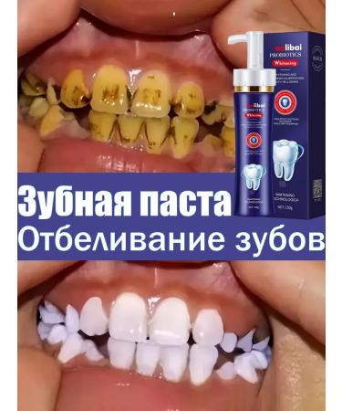 bleaching toothpaste 150g
