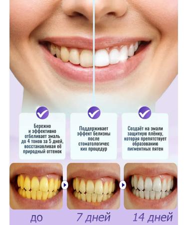 bleaching toothpaste 150g - Buy Online on GoSupps.com