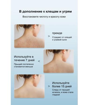 IUALLURE Shower gel effectively fights bacteria and acne 300 ml - Buy Online on GoSupps.com