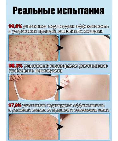 IUALLURE Shower gel effectively fights bacteria and acne 300 ml - Buy Online on GoSupps.com