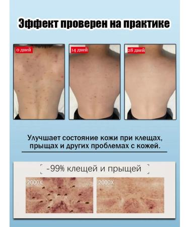 IUALLURE Shower gel effectively fights bacteria and acne 300 ml - Buy Online on GoSupps.com