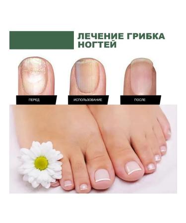 Hands of the legs special antibacterial repair Care liquid - Buy Online on GoSupps.com