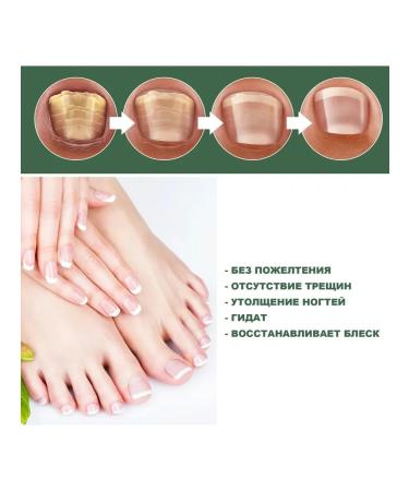 Hands of the legs special antibacterial repair Care liquid - Buy Online on GoSupps.com