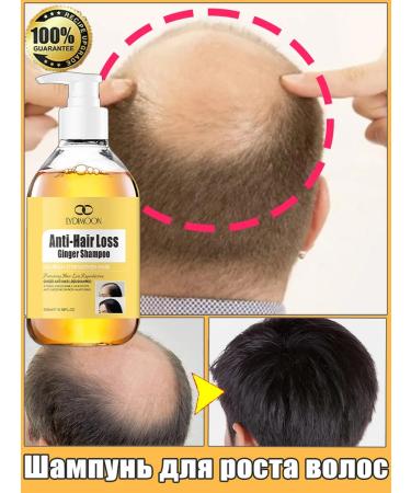 LYDIMOON Shampoo for hair growth and against falling out strengthens