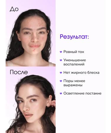 LAB Facial serum from acne and black dots with niacinamide - Buy Online on GoSupps.com