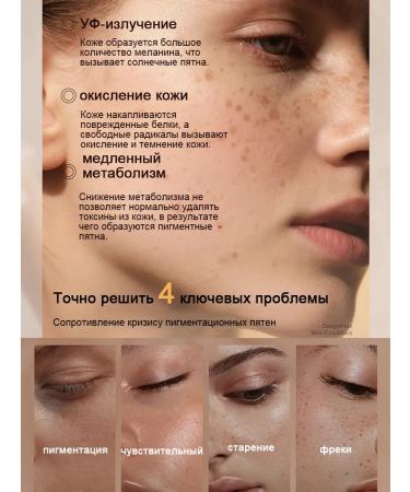 Cream against age spots and freckles to combat them - Buy Online on GoSupps.com