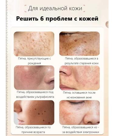 Cream against age spots and freckles to combat them - Buy Online on GoSupps.com