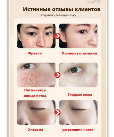 Cream against age spots and freckles to combat them - Buy Online on GoSupps.com