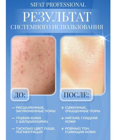 Sifat professional Enzyme powder for washing 150 ml - Buy Online on GoSupps.com