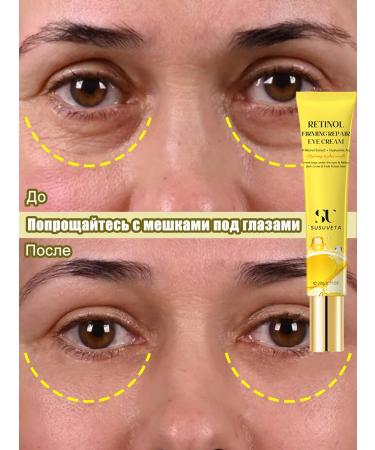 Cream for removing bags under the eyes of 20 g