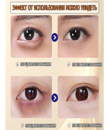 Cream for removing bags under the eyes of 20 g - Buy Online on GoSupps.com