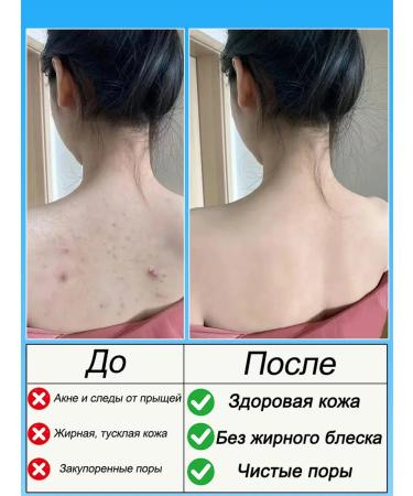 IUALLURE Shower gel with acids acne for all skin types 300 ml - Buy Online on GoSupps.com