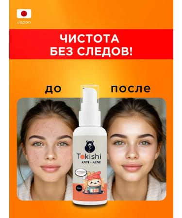 TOKISHI SB Acne cream serum